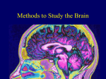 Module 11: Methods to Study the Brain