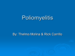 Polimyelitis