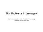 PowerPoint on skin problems in teenagers
