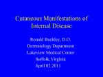 Paraneoplastic Syndromes and Cutaneous Signs of Malignancy