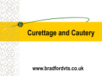 Curettage and Cautery