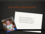 Port Wine birthmark presentation