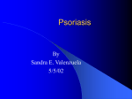 Psoriasis - Cal State LA - Instructional Web Server