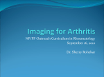 Imaging for Arthritis