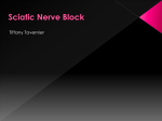 Sciatic Nerve Block