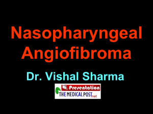 Nasopharyngeal angiofibroma - The Medical Post | Trusting