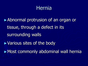 Hernia – incidence