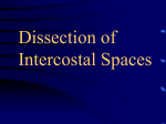 Dissection of Intercostal Spaces