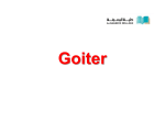 2. GOITER