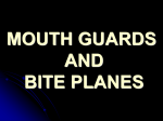 mouth gaurds and bite planes