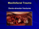 Dento-alveolar fractures