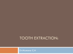 Tooth extraction