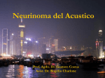 Neurinoma del Acustico. Prof Agdo Dr Gustavo Costas. Asist Dr