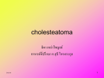 cholesteatoma