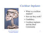 Cochlear Implants - UW-W