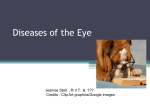 Diseases of the Eye CC