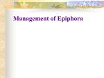 Management of Epiphora