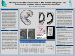 3D computerized reconstruction of the human embryonic lens