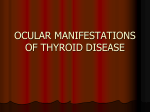 OCULAR MANIFESTATIONS OF THYROID DISEASE
