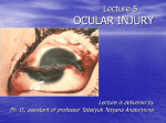 blunt injuries of the eyeball