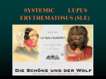 Systemic_Lupus_Erythematosus