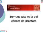 Sistema inmunológico/inflamatorio y cáncer de próstata