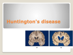 Huntington`s disease