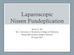 Nissen Fundoplication - University of Kentucky | Medical Center