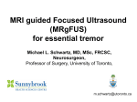 Dr. Schwartz Presentation on MRI guided Focused Ultrasound for ET