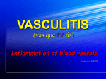 VASCULITIS (vas cue lie tis) - Vasculitis Patient Information