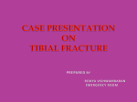 CASE PRESENTATION ON TIBIAL FRACTURE