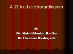 lecture 4 A 12-lead electrocardiogram (ECG)