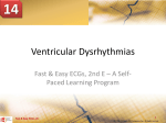 reperfusion dysrhythmia - McGraw Hill Higher Education