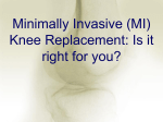 Minimally Invasive Knee Replacement