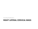 Left tender Cervical Mass