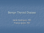 Benign Thyroid Disease
