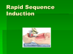 Rapid Sequence Induction
