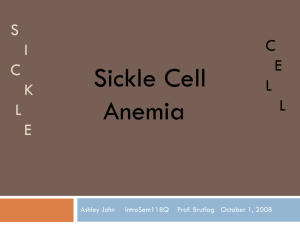 Ashley John - Sickle Cell Anemia