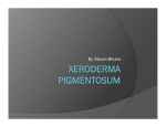 Steven Bhutra - Xeroderma Pigmentosum