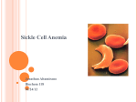 Jonathan Altamirano - Sickle Cell Anemia