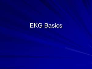 EKG Basics - Long