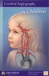 Download our booklet on pediatric cerebral angiography
