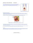 in-depth article about sphincter of Oddi dysfunction