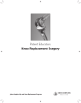 Knee Replacement Surgery Patient Education Guide