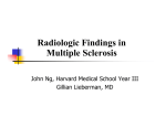 Radiologic Findings in Multiple Sclerosis
