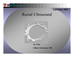 Rectal Ultrasound