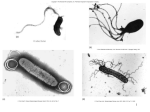 Vibrio metchnikovii