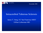Intracerebral Tuberous Sclerosis
