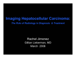 Imaging Hepatocellular Carcinoma: The Role of Radiology in Diagnosis Treatment