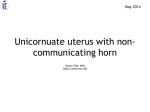 Unicornuate Uterus With Non-communicating Horn